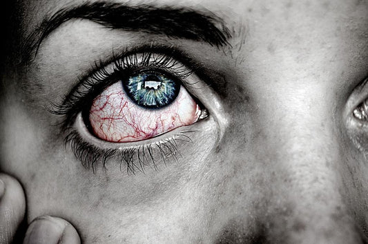36 Simple Home Remedies For Dry Eyes That Really Work